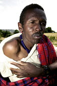 Conservation Issues: Maasai tribesman shows injury from crop raiding elephant attack Africa,Conservation,issue,issues,conservation issues,conservation issue,threat,threatened,marauding,elephant,Maasai,tribesmen,tribe,tribes,people,injury,scar,injured,attack,attacked,Elephants,Elephant